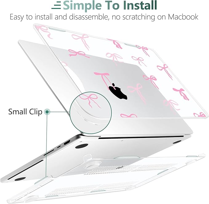 DONGKE Case for MacBook Pro 14 Inch (2026-2021 Release, M5 M4 M3 M2 M1 Pro/Max Chip), Plastic Slim Hard Shell Protective Cover with Keyboard Cover & Screen Protector, Pink Bows