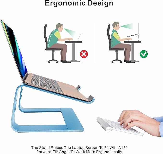 Laptop Stand,Ergonomic Aluminum Laptop Mount Computer Stand,Detachable Laptop Riser,Notebook Holder Stand,All 10-17.3" Laptops (Sky Blue)